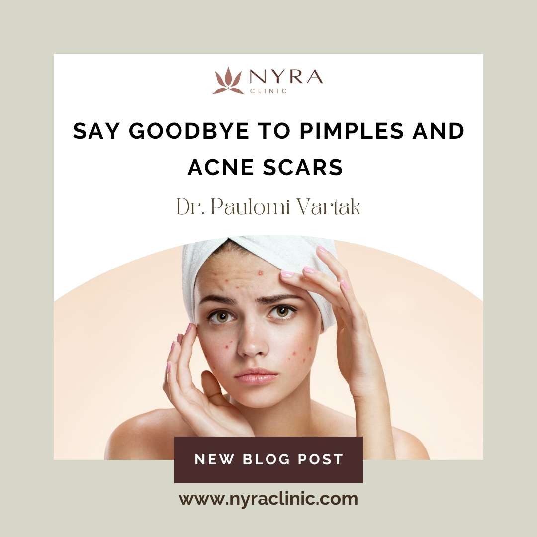 Advance Acne Scar Treatments in Pune | Nyra Clinic
