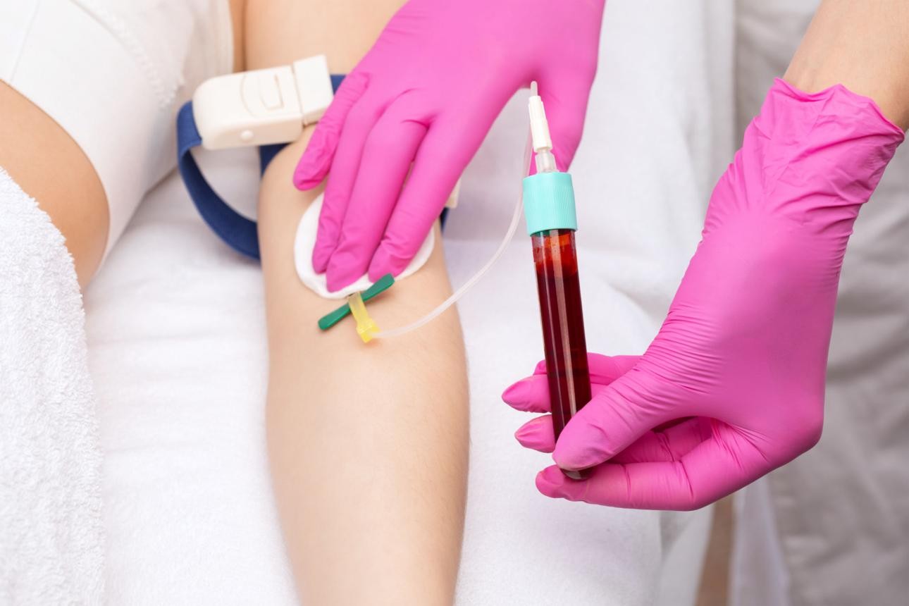 PRP hair treatment Pune