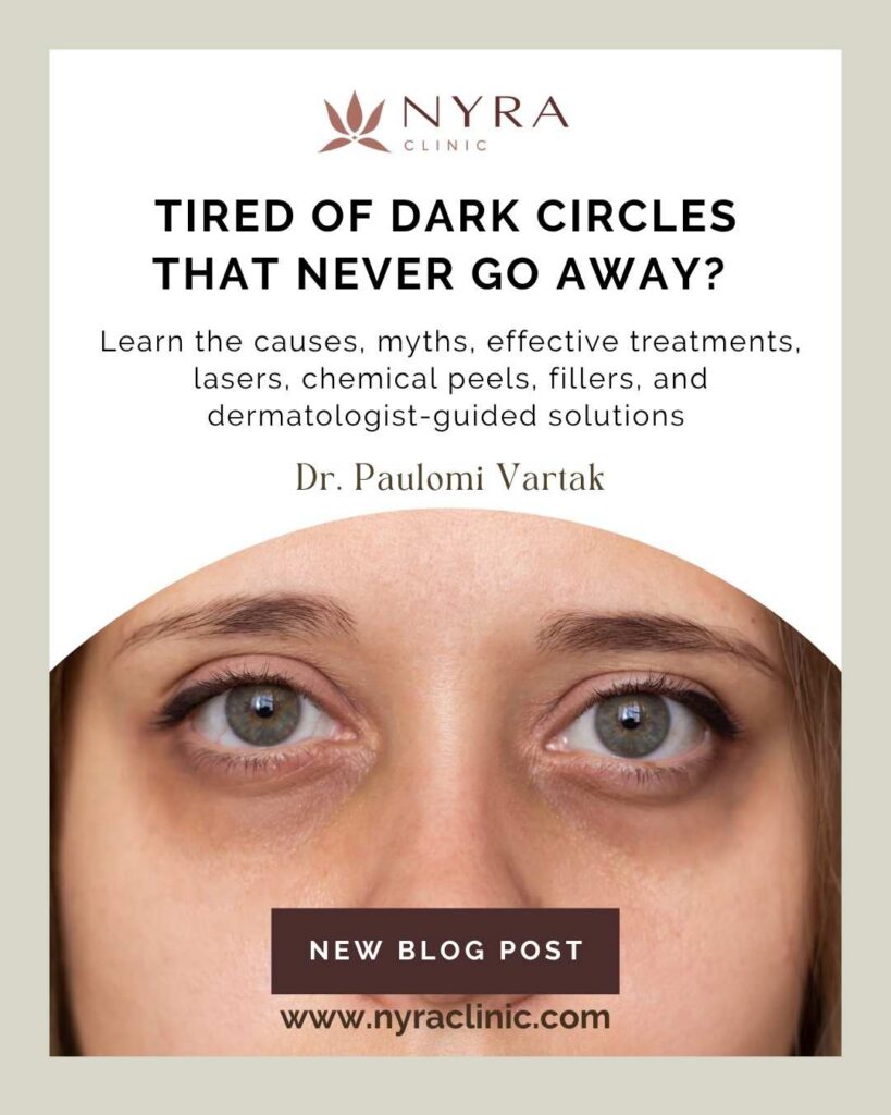 Dark Eye Circle Treatment in Pune | Nyra Clinic Balewadi