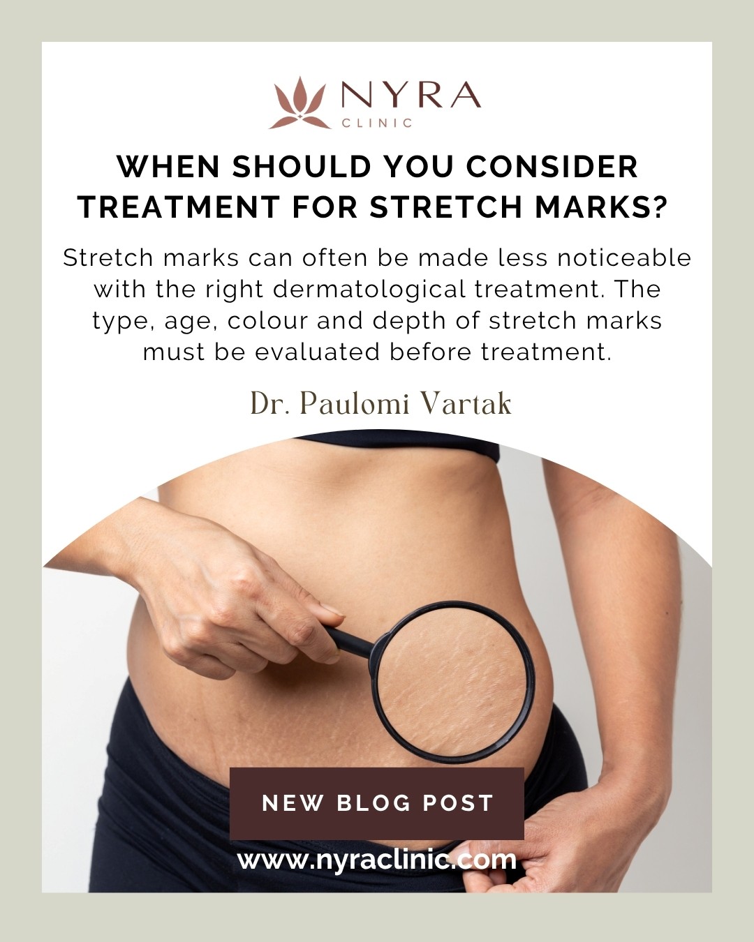 Stretch Mark Reduction Treatment in Pune